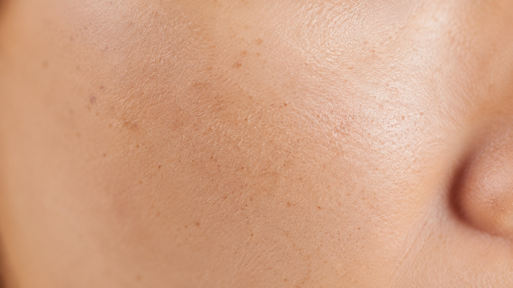 Post-Acne Marks and Enlarged Pores: The Treatment Combination Trending in Korea